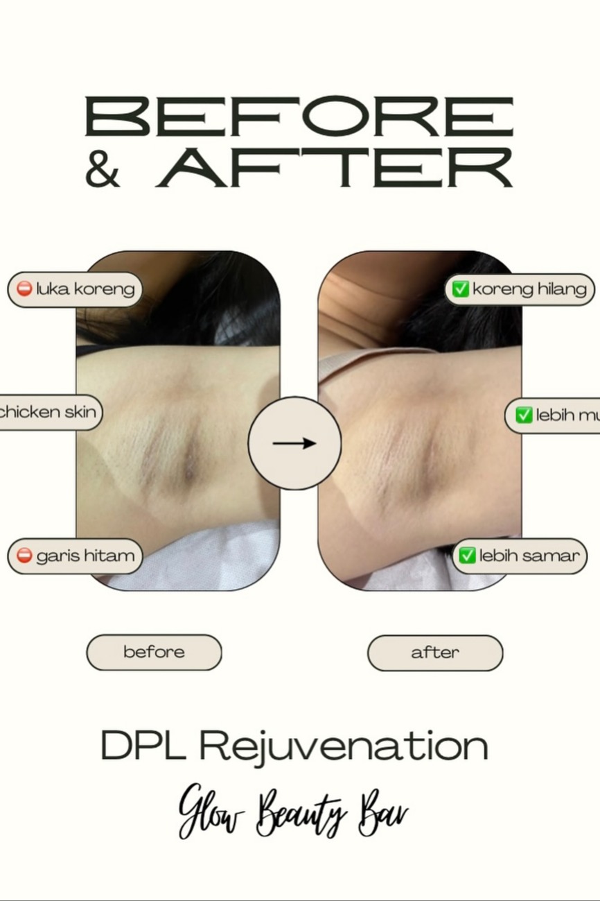 Glow Beauty Experience 13