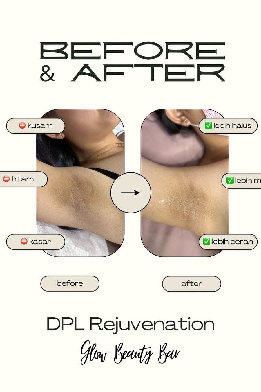 Glow Beauty Experience 12